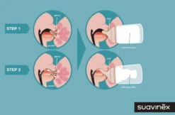 Suavinex Zero.Zero Anti-Colic Slow Flow Zuigfles 180ml SXZBRF051118 -Bekende Babyartikelen Winkel suavinex zer .zer anti colic zuigfles 3 1